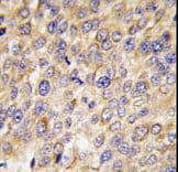 Polyclonal Rabbit anti-Human GABARAP Antibody (aa1-30, IHC, IF, WB)