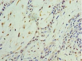 NR4A1 / NUR77 Antibody (aa1-170)