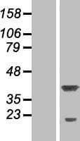 RPRD1A Protein (Over-Expression Lysate Myc-DDK (Flag))
