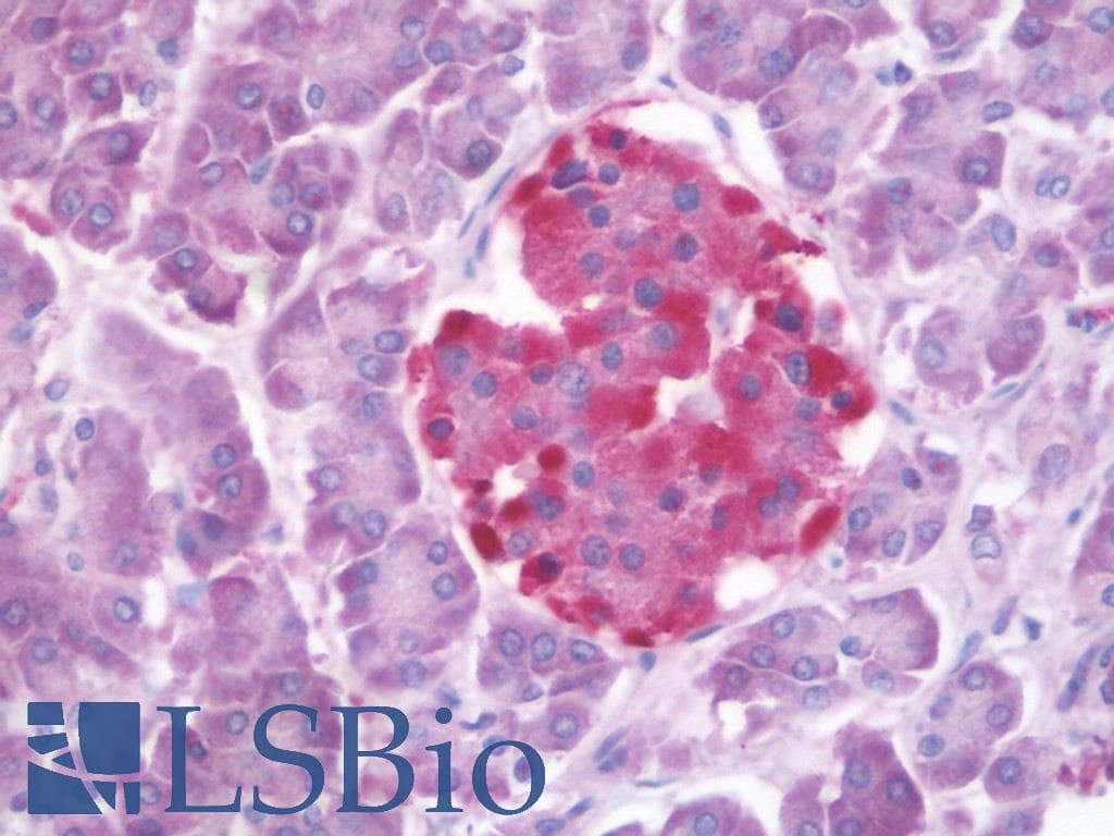 PathPlus™ Polyclonal Rabbit anti-Human GLP1R / GLP-1 Receptor Antibody (N-Terminus, IHC)