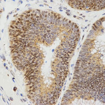 Polyclonal Rabbit anti-Human LHB / Luteinizing Hormone Antibody (IHC, WB)