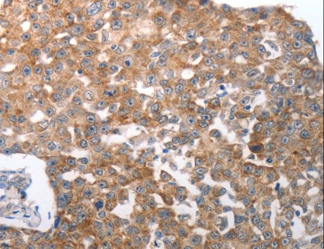 NQO2 Antibody