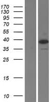 TARBP2 / TRBP2 Protein (Over-Expression Lysate Myc-DDK (Flag))