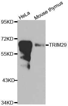 Polyclonal Rabbit anti-Human TRIM29 Antibody (IHC, WB)