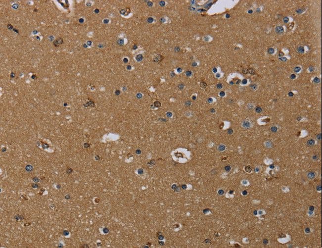 Polyclonal Rabbit anti-Human GBP5 Antibody (IHC)