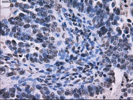 RPA2 / RFA2 / RPA34 Antibody (clone OTI1H10)