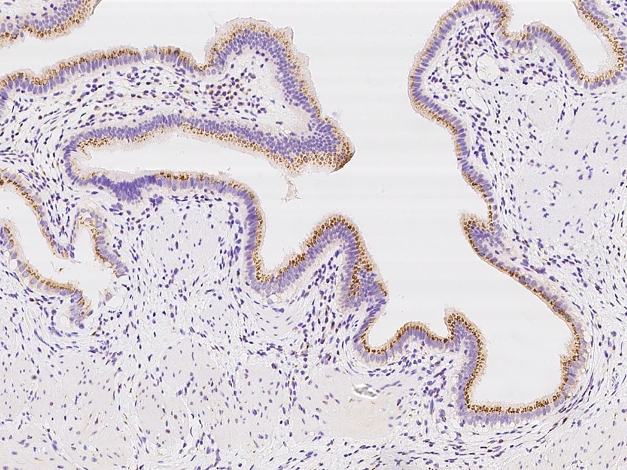 Polyclonal Rabbit anti-Human SDF4 Antibody (IHC, IF)