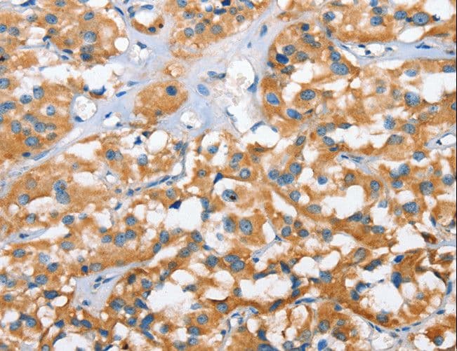 BRAK / CXCL14 Antibody