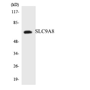Polyclonal Rabbit anti-Human SLC9A8 / NHE8 Antibody (aa440-489, WB)