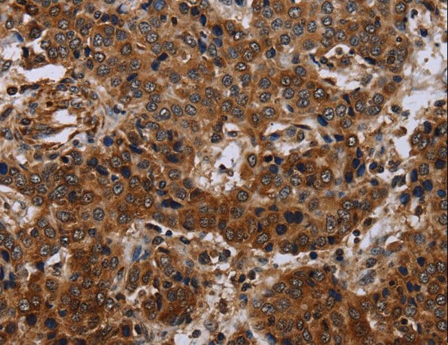 Polyclonal Rabbit anti-Human SLC1A6 / EAAT4 Antibody (IHC, WB)