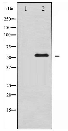 CHEK1 / CHK1 Antibody