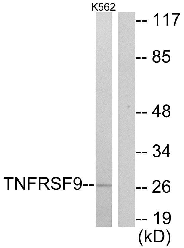 Polyclonal Rabbit anti-Human TNFRSF9 / 4-1BB / CD137 Antibody (WB)