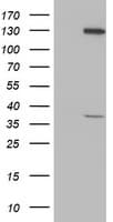 PIH1D2 Antibody (clone OTI4A10)