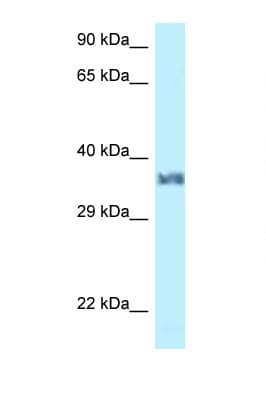 Polyclonal Rabbit anti-Mouse Lumican Antibody (aa59-108, WB)