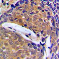 CSTB / Cystatin B / Stefin B Antibody (Internal)