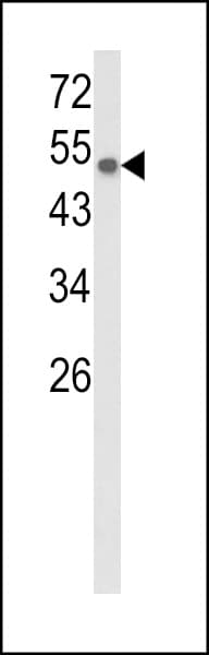 PGIS / PTGIS Antibody (aa472-500)