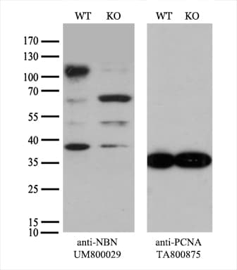 NBN / Nibrin Antibody (aa461-754, clone UMAB99)