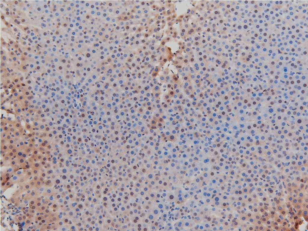 LIMK1 / LIMK Antibody (phospho-Thr508)