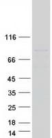 Human TGM5 / Transglutaminase 5 Protein (Recombinant Myc-DDK (Flag))