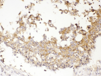NDRG3 Antibody