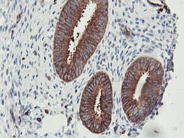 Monoclonal Mouse anti-Human PFKP Antibody (clone OTI3A12, IHC, IF, WB)
