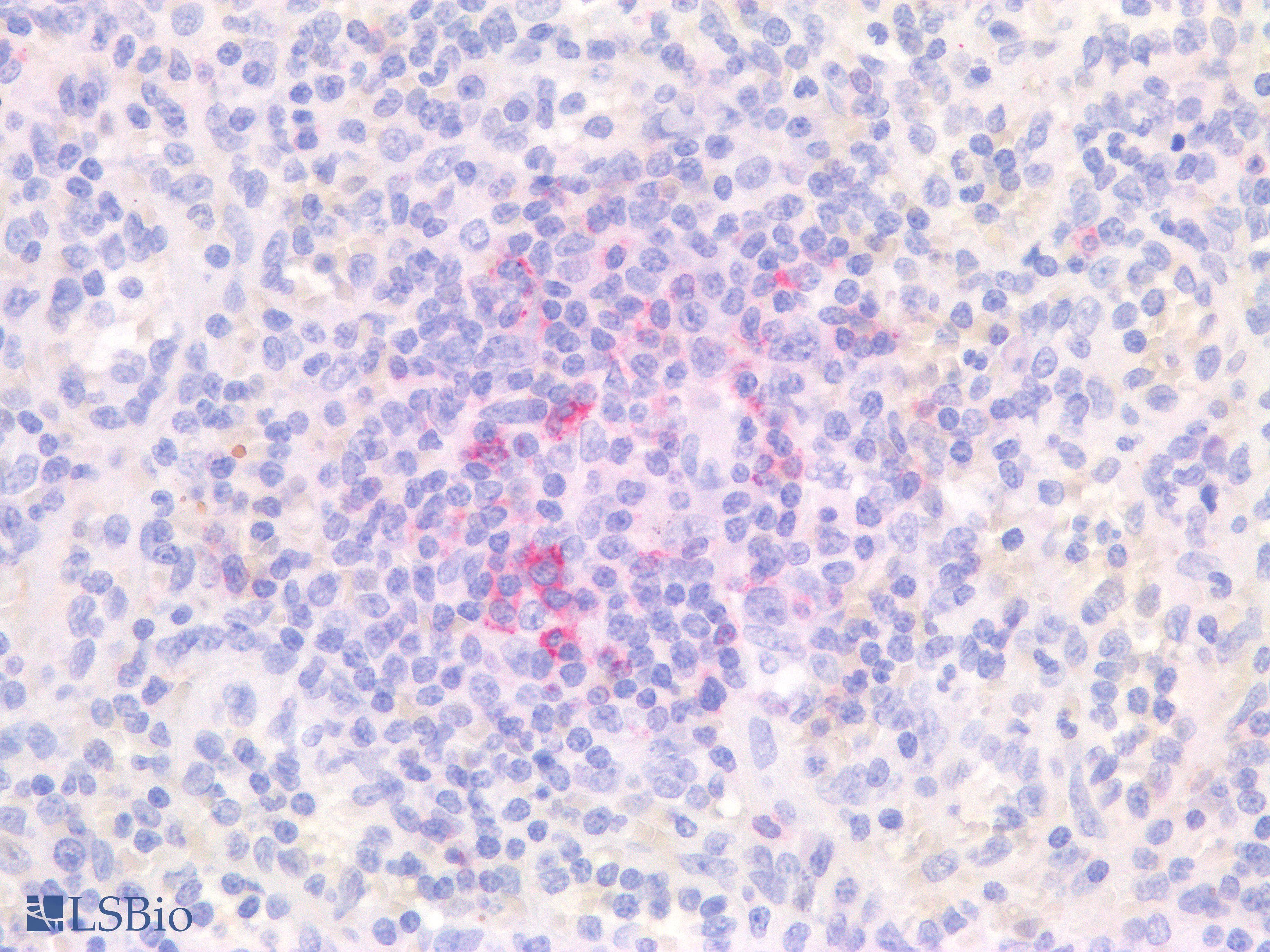 PathPlus™ PDCD1 / CD279 / PD-1 Antibody (clone AHC0211)