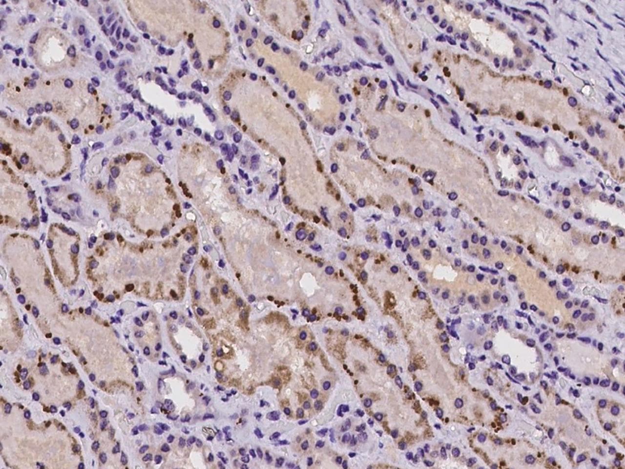 Polyclonal Rabbit anti-Human HPS3 Antibody (IHC)