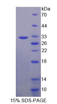Human PCSK9 Protein (Recombinant His)