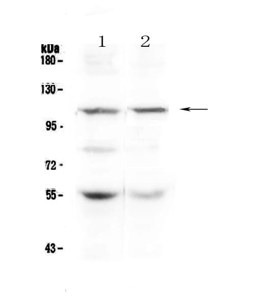 Polyclonal Rabbit anti-Human DPYD / DPD Antibody (WB)