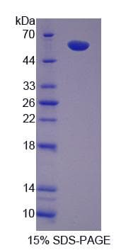 Mouse ITK / EMT Protein (Recombinant His-S)