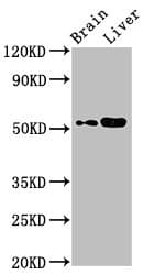 Polyclonal Rabbit anti-Human GALNAC4ST-2 / CHST9 Antibody (IHC, WB)