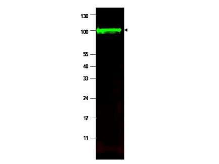 IHC-plus™ PPP1R13L / iASPP Antibody