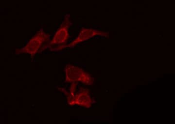 Polyclonal Rabbit anti-Human PTCH1 / Patched 1 Antibody (IHC, IF, WB)