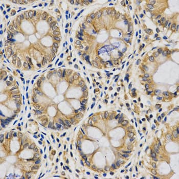 CYB5A / Cytochrome b5 Antibody