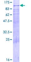 Human DDX4 / VASA Protein (Recombinant GST)