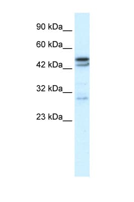Polyclonal Rabbit anti-Human CHRNA3 Antibody (aa26-75, IHC, WB)