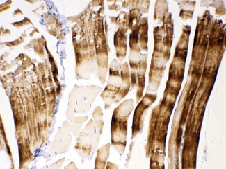 Polyclonal Rabbit anti-Human ACTN3 Antibody (IHC, WB)