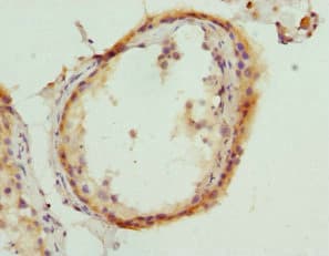 HMGCL Antibody