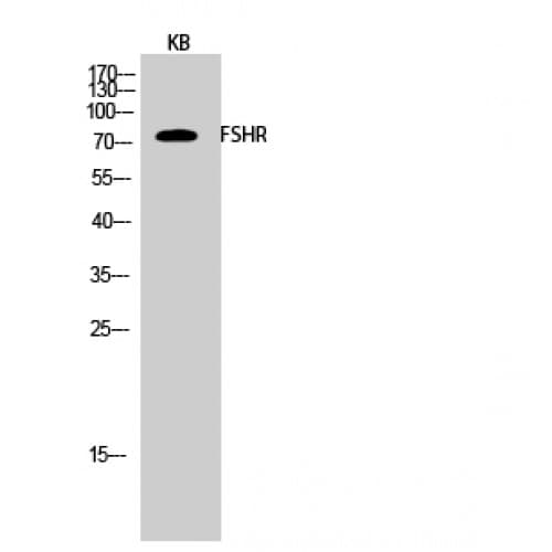 FSH Receptor / FSHR Antibody (180-260 aa, Internal)