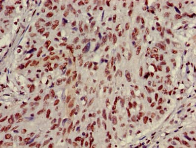 HIST1H3A Antibody