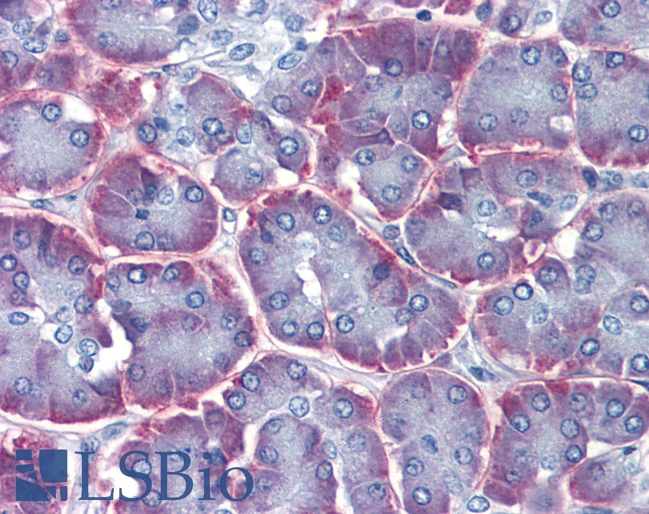 Polyclonal Rabbit anti-Human IMPDH1 Antibody (aa254-303, IHC, WB)