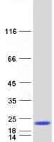 Human SNX3 Protein (Recombinant Myc-DDK (Flag))