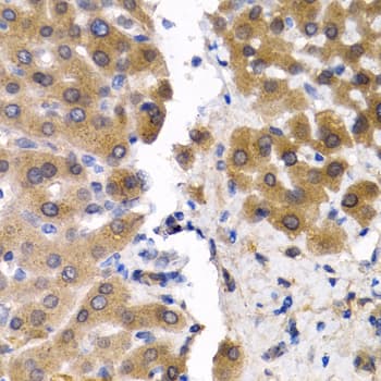 SCP2 / SCPX Antibody