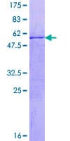 Human CENPQ Protein (Recombinant GST)
