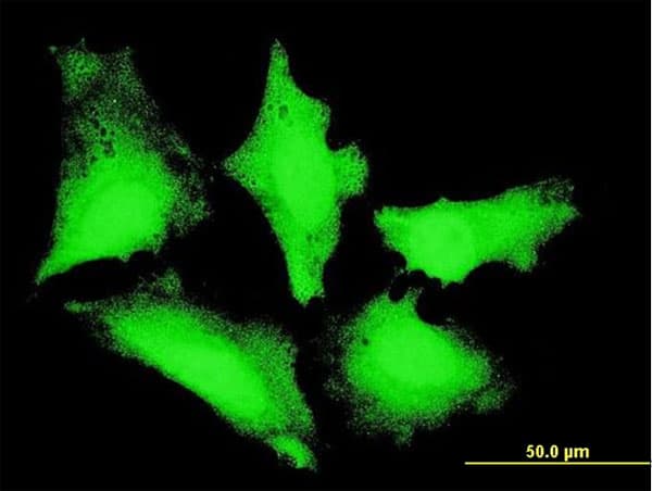 Monoclonal Mouse anti-Human PIBF1 / PIBF Antibody (clone 7B7, IHC, IF, WB)