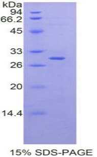 Rat MSN / Moesin Protein (Recombinant His-T7)