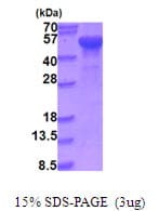 Human HADHB Protein (Recombinant His)