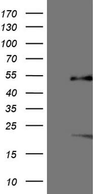 NR5A1 / SF1 Antibody (aa1-262, clone OTI1B4)