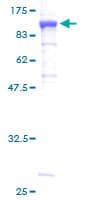 Human MUT / MCM Protein (Recombinant GST)