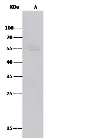 MICA Antibody (Preservative Free)